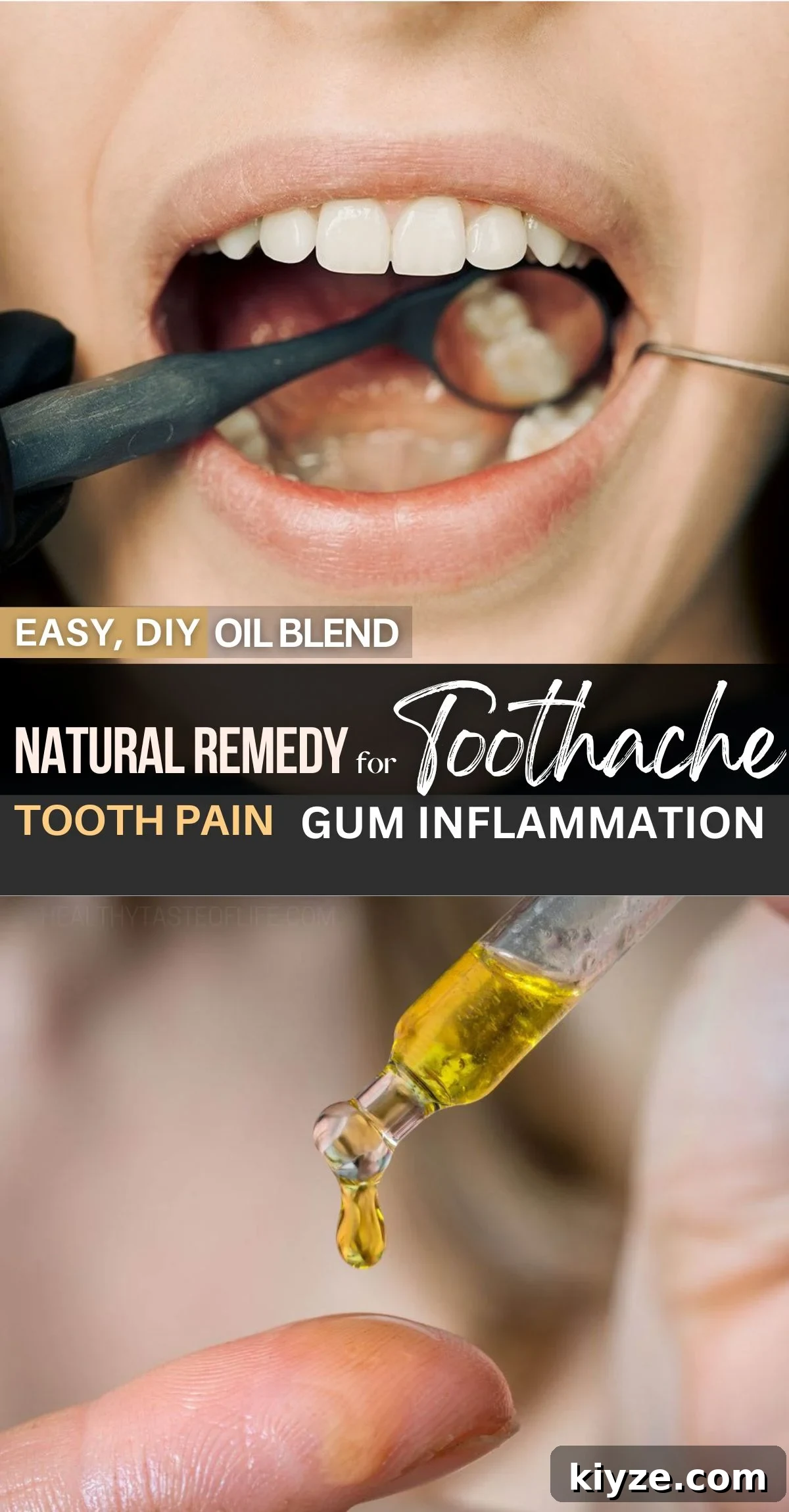 DIY Natural Oil Blend for Toothache Pain Relief 14 This blend of oils for toothache is a great all-natural home remedy to relieve dental pain and gum inflammation. This DIY oil is great for stopping a toothache whether is dull or throbbing and bring pain relief in minutes. Oils for tooth pain, inflammation; natural home remedy for tooth pain relief, natural antibiotic for toothache and infection. #toothache #painrelief #naturalremedy #toothpain #naturalremedy