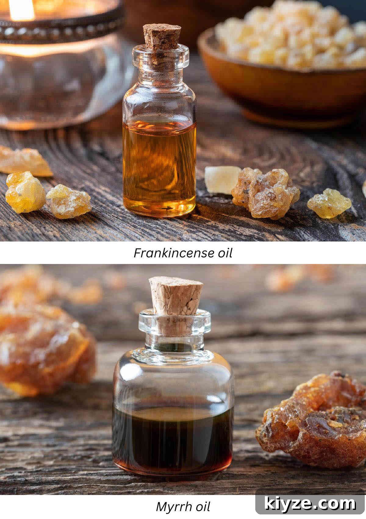 DIY Natural Oil Blend for Toothache Pain Relief 8 Frankincense oil and myrrh oil for toothache pain inflammation.